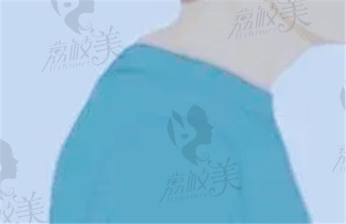 微创乳化富贵包一次能消除吗