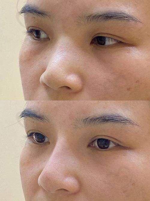 天津美琳医疗美容门诊部真人口碑评价怎么样？
