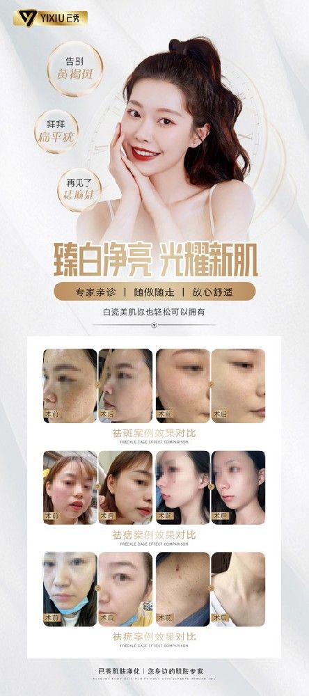 留纤减肥店全国连锁
