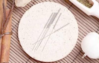 針灸減肥多久能瘦下來，針灸減肥重在規(guī)范和堅持 針灸減肥 第4張