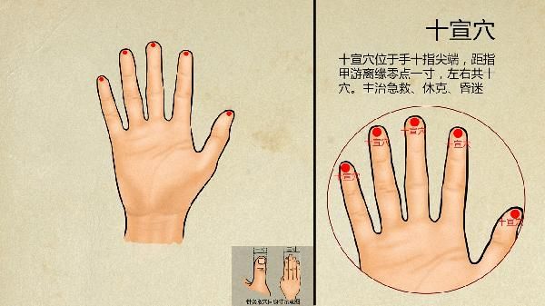中醫(yī)針灸一次多少錢