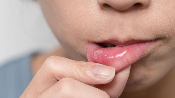 冬季易上火 吃什么可以去火