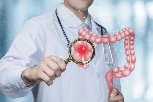 【自測(cè)】很多人可能已經(jīng)被腸癌盯上了！1分鐘自測(cè)腸道健康，你中招了嗎？