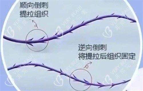 倒刺形狀線材樣子圖解