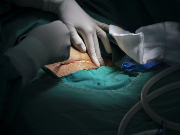 懷二胎剖腹產(chǎn)需要注意什么 懷二胎剖腹產(chǎn)注意事項解析