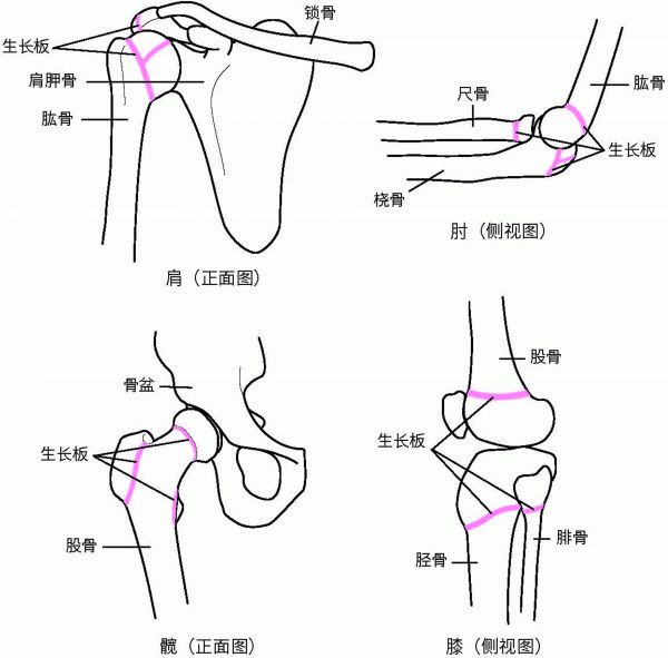 生长板定位