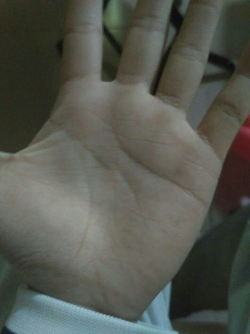 掌纹突然变化预示什么