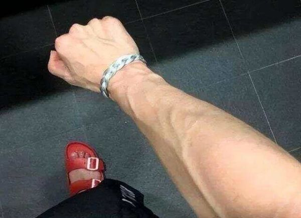 血管好不好，看手臂就知？医生：血管硬的人，手臂一般有这2共性
