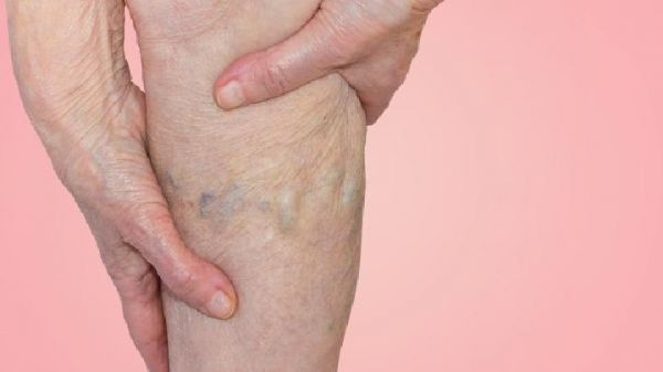 营养师解密马鞭草瘦腿茶