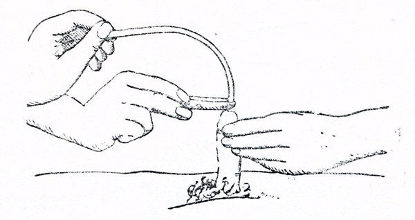 等滲性脫水又叫什么