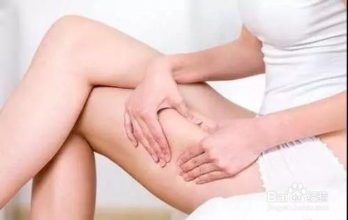 怎樣區(qū)分肥胖和水腫？