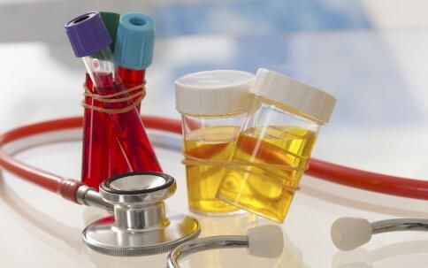 體檢套餐越貴越好嗎 應(yīng)該怎么選擇體檢機(jī)構(gòu) 體檢項(xiàng)目應(yīng)該怎么選