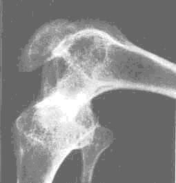 【科普】維生素 D 到底要不要補？