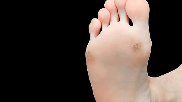 正確的鹽水泡腳方式