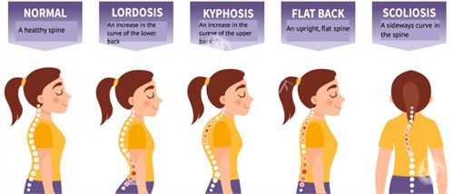 富贵包对体态的影响