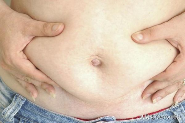 跑步，是內(nèi)臟脂肪和皮下脂肪的“共同的敵人”