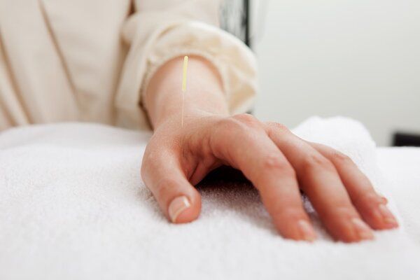 北京針灸三分鐘減肥