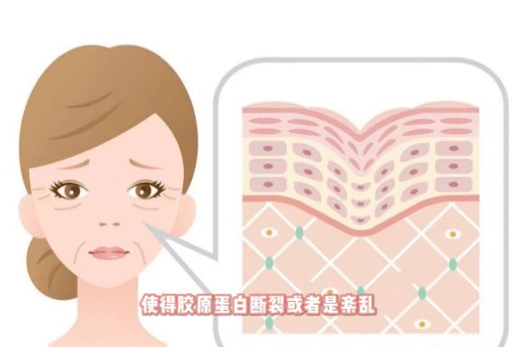 肌膚糖化有哪些表現(xiàn)，要怎么改善？插圖