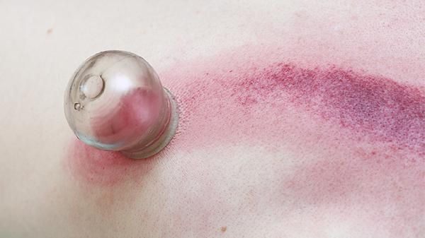 拔罐減肥的食譜有哪些