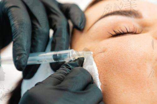 優(yōu)脂塑吸脂瘦手臂實(shí)例分享：真人反饋真實(shí)有效