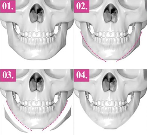 原來輪廓三件套是這樣做的！
