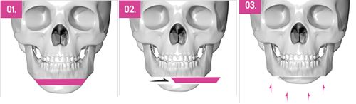 原來輪廓三件套是這樣做的！