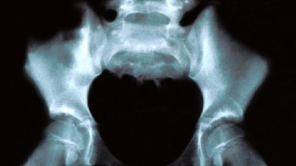 坐月子期間如何減肥？抓住坐月子黃金期開始減肥