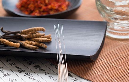 中醫(yī)針灸很養(yǎng)生 針灸小心這些禁忌