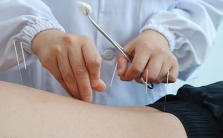 中醫(yī)針灸很養(yǎng)生 針灸小心這些禁忌