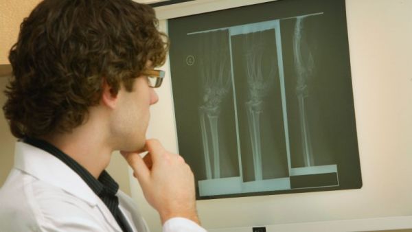 如何增強(qiáng)骨密度