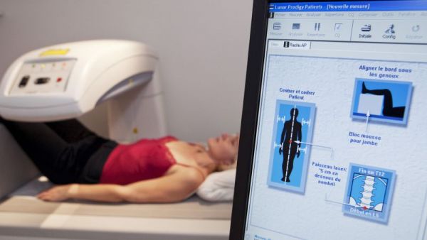 骨密度的正常值