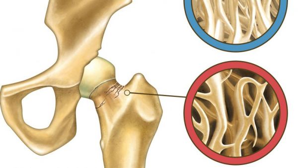 嬰兒骨密度的正常值