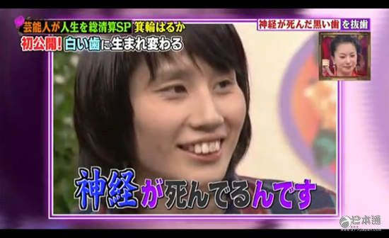 戶田惠梨香 大島優(yōu)子 藤原紀(jì)香 箕輪遙 牙齒