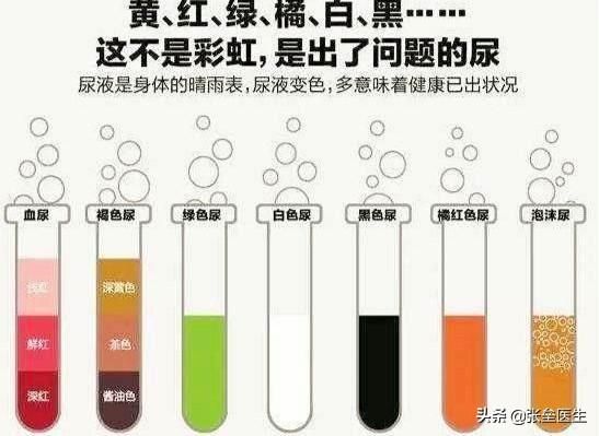 深度辟谣：尿常规正常就说明肾脏没问题？肾内科医生一文讲清楚