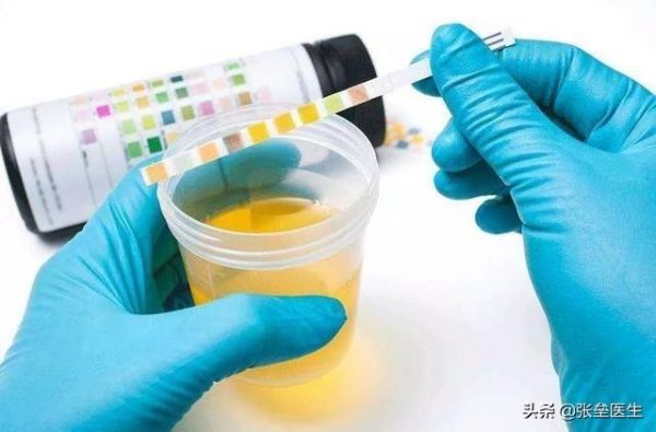 深度辟谣：尿常规正常就说明肾脏没问题？肾内科医生一文讲清楚