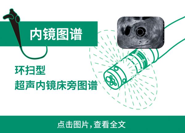 環(huán)掃型超聲內(nèi)鏡床旁圖譜-文章鏈接圖-01.jpg