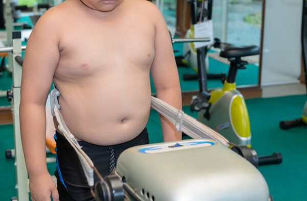 儿童肥胖减肥办法有哪些