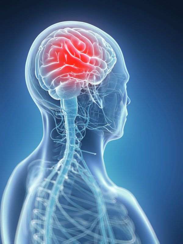 脑出血病人手麻是什么原因引起的