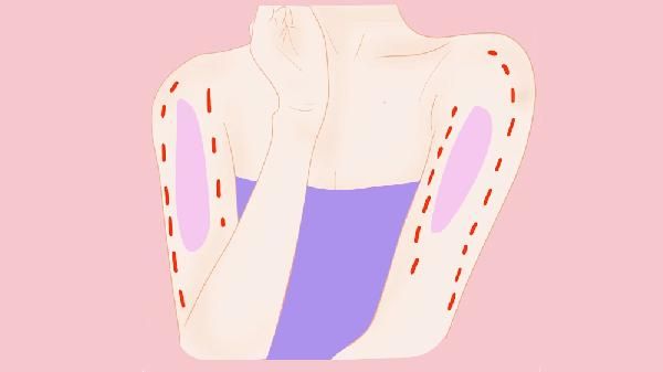 蝶臂贴瘦手臂真的有效吗