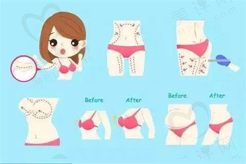 燃脂炮需要做几次才有成效