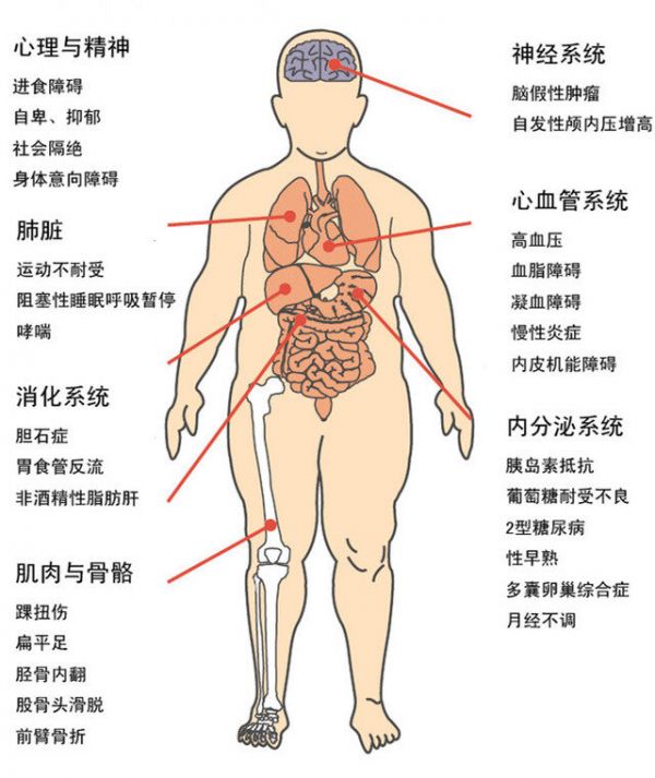 肥胖症并发症_副本.jpg