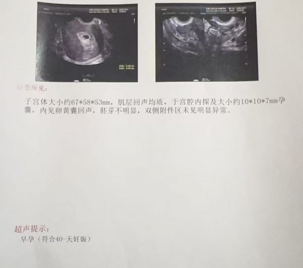 智塑未來(lái), 宮腹腔鏡消積水，精細(xì)調(diào)理促移植！花生&middot;五洲專(zhuān)家助二胎圓夢(mèng)