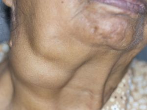 醫(yī)學排名：北京華壇甲狀腺醫(yī)院“醫(yī)師評分榜”減脂期別傷甲狀腺，裴海旭指導科學減重