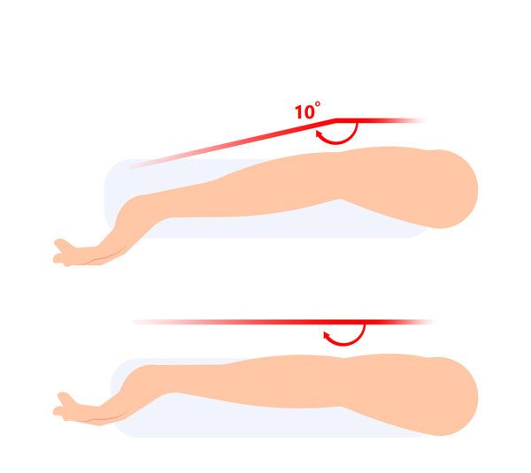 肘关节脱臼康复训练