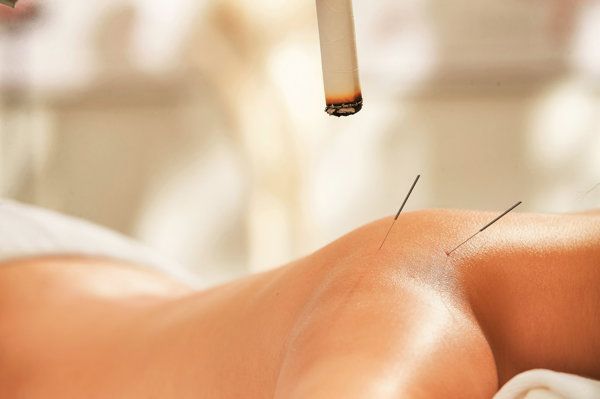 惊恐发作治疗可以针灸吗