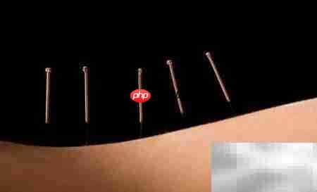 针灸注意事项须知