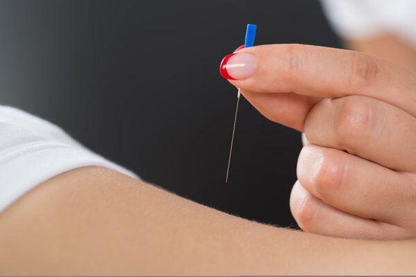 針灸一療程多少天