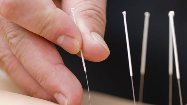 針灸的功效