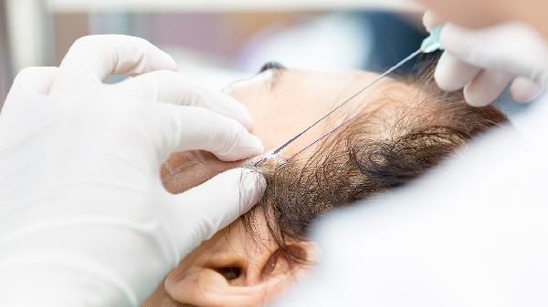 埋线减肥法应注意什么 埋线减肥需要注意五个事项