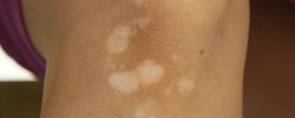 心理健康10条：守护心灵健康防线